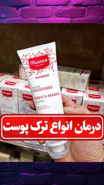 کرم ضد ترک بارداری موستلا ۱۵۰ میلی لیتر